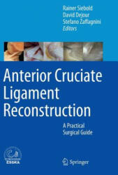 Anterior Cruciate Ligament Reconstruction - Rainer Siebold, David Dejour, Stefano Zaffagnini (2014)