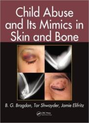 Child Abuse and its Mimics in Skin and Bone (ISBN: 9781439855355)