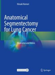 Anatomical Segmentectomy for Lung Cancer (ISBN: 9789819958566)
