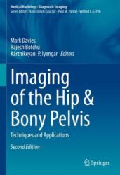Imaging of the Hip & Bony Pelvis (ISBN: 9783031765452)