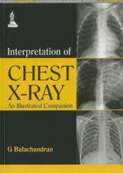 Interpretation of Chest X-Ray - G. Balachandran (2014)