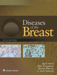 Diseases of the Breast - Jay R Harris (2014)