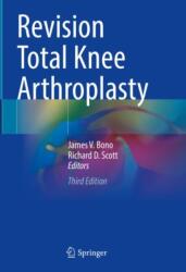 Revision Total Knee Arthroplasty (ISBN: 9783031619793)