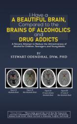 I Have a Beautiful Brain, Compared to the Brains of Alcoholics and Drug Addicts (ISBN: 9798889109891)
