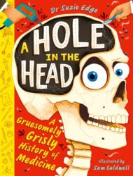 A Hole in the Head (ISBN: 9781444975338)
