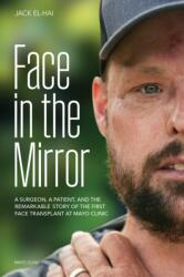 Face Transplant (ISBN: 9798887700281)
