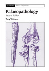 Palaeopathology (ISBN: 9781108730884)