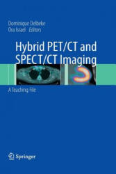 Hybrid PET/CT and SPECT/CT Imaging - Dominique Delbeke, Ora Israel (ISBN: 9781493950744)