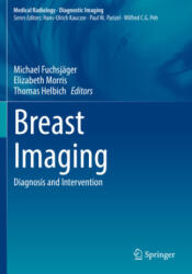 Breast Imaging - Michael Fuchsjäger, Elizabeth Morris, Thomas Helbich (ISBN: 9783030949204)