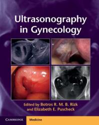 Ultrasonography in Gynecology - Botros R. M. B. Rizk, Elizabeth E. Puscheck (2014)