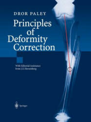 Principles of Deformity Correction - Dror Paley, J. E. Herzenberg (2014)