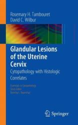 Glandular Lesions of the Uterine Cervix - Rosemary H. Tambouret, David C. Wilbur (2014)