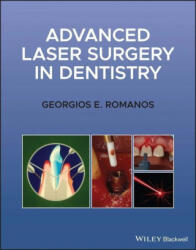 Advanced Laser Surgery in Dentistry - Georgios E. Romanos (ISBN: 9781119583301)