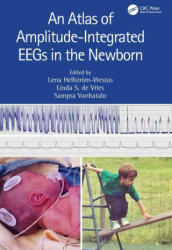 An Atlas of Amplitude-Integrated EEGs in the Newborn - Linda S De Vries, Sampsa Vanhatalo (ISBN: 9781032258508)