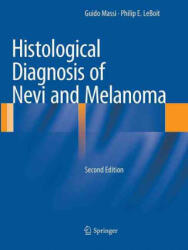 Histological Diagnosis of Nevi and Melanoma - Guido Massi, Philip E. LeBoit (ISBN: 9783662500156)