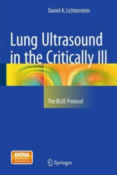 Lung Ultrasound in the Critically Ill - Daniel A. Lichtenstein (ISBN: 9783319153704)