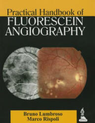 Practical Handbook of Fluorescein Angiography - Bruno Lumbroso, Marco Rispoli (2014)