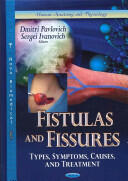 Fistulas & Fissures - Types Symptoms Causes & Treatment (2013)