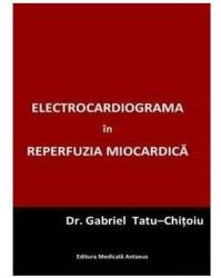 Electrocardiograma în reperfuzia miocardică (2014)