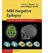 MRI-Negative Epilepsy: Evaluation and Surgical Management - Elson L. So, Philippe Ryvlin (2015)