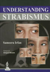Understanding Strabismus - Sameera Irfan (2013)