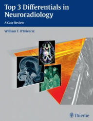 Top 3 Differentials in Neuroradiology - William T. O'Brien (2015)