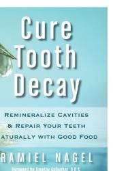 Cure Tooth Decay - Ramiel Nagel (ISBN: 9780982021323)