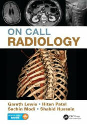 On Call Radiology - Shahid Hussain (2015)