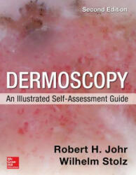 Dermoscopy: An Illustrated Self-Assessment Guide, 2/e - Wilhelm Stolz (2015)