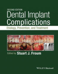 Dental Implant Complications - Etiology, , and Treatment, Second Edition - Stuart Froum (2015)