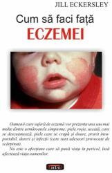 Cum să faci faţă eczemei (2008)