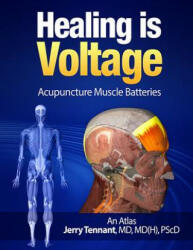 Healing is Voltage: Acupuncture Muscle Batteries - MD Jerry L Tennant MD (ISBN: 9781508500728)