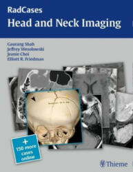 RadCases Head and Neck Imaging - Gaurang Vrindavan Shah, Jeffrey Robert Wesolowski, Jeanie M. Choi, Elliott Friedman (ISBN: 9781604061932)
