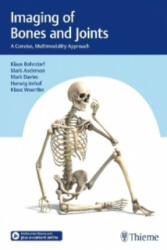 Imaging of Bones and Joints - Klaus Bohndorf, Mark W. Anderson, Arthur Mark Davies, Herwig Imhof, Klaus Wörtler (2016)