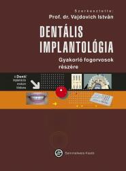 Dentális implantológia - Gyakorló fogorvosok részére (ISBN: 9789633314111)