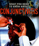 What You Need to Know about Conjunctivitis (ISBN: 9781474711913)