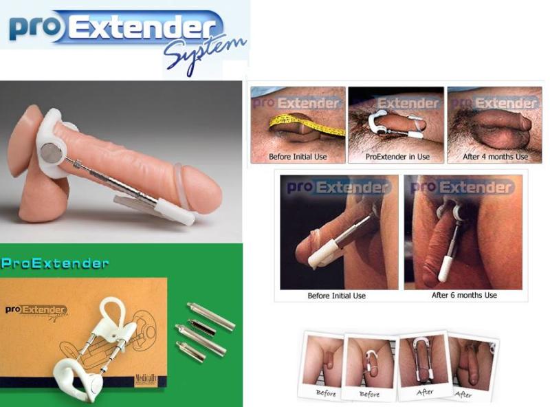 problémamentes erekciós eszköz gyakorlatok a pénisz javítására