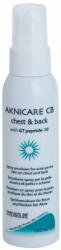 Synchroline Aknicare CB емулсия в спрей за редуциране проявите на акне по гърдите и гърба 100ml