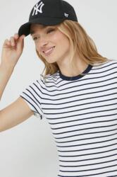Abercrombie & Fitch t-shirt női, fehér - fehér XXS - answear - 11 990 Ft