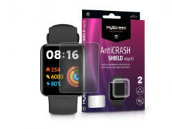 MyScreen Protector AntiCrash Shield Edge3D Xiaomi Redmi Watch 2 Lite ütésálló képernyővédő fólia 2db/csomag (LA-2165)