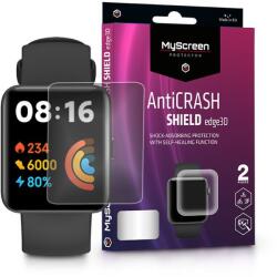MyScreen Protector AntiCrash Shield Edge3D Xiaomi Redmi Watch 2 Lite ütésálló képernyővédő fólia 2db/csomag (LA-2165) (LA-2165) (LA-2165)