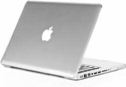  Kuzy - CLEAR 17" kristálykemény tok MacBook Pro 17" modellhez: A1297 alumínium unibody (B019QVI1ZE)