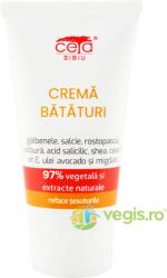 CETA SIBIU Crema pentru Bataturi cu Galbenele si Vitamina E 97% Vegetala 50ml