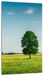 Mivali Tablou cu copaci pe luncă, dintr-o bucată 20x30 cm (V021171V2030)