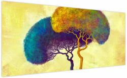 Mivali Tablou - Copaci în deal, dintr-o bucată 200x100 cm (V022537V200100)