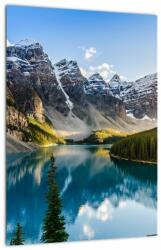 Mivali Tablou - Kanada. Parcul național Banff, Moraine Lake, dintr-o bucată 30x40 cm (V021763V3040)
