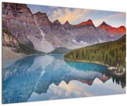 Mivali Tablou - Peisaj montan din Canada, dintr-o bucată 90x60 cm (V021993V9060)