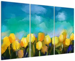 Mivali Tablou - Lalele galbene, din trei bucăți 120x80 cm (V023348V120803PCS)