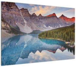 Mivali Tablou - Peisaj montan din Canada, dintr-o bucată 100x70 cm (V021993V10070)