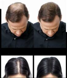 Csomag x 3 Hajépítő szálak, Ritka hajszálak, hajhiány miatt, Sevi (Pach3Sev02)